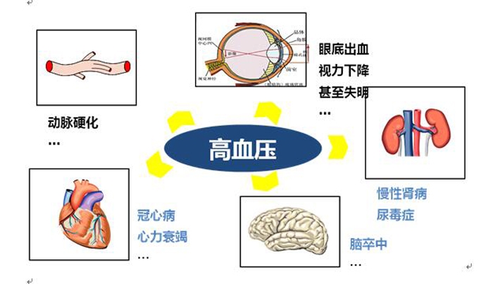 高血压有哪些临床表现 长期坚持健康的